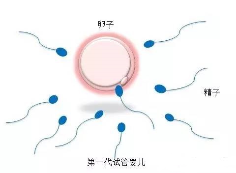 染色体易位